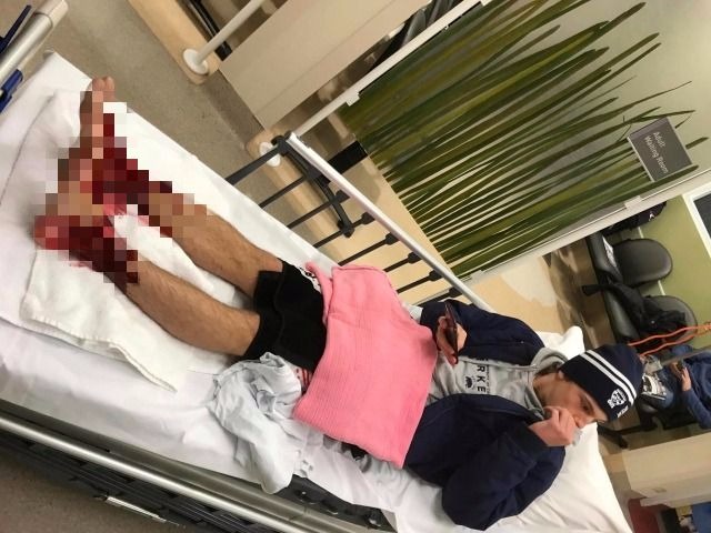 Jako z&nbsp;hororu! Mladík skončil v&nbsp;nemocnici po&nbsp;záhadném mořském útoku. VIDEO