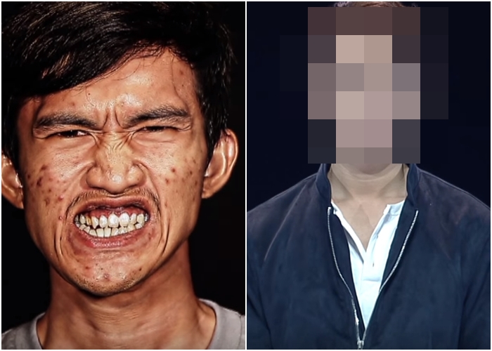 To není jedna a&nbsp;ta samá osoba! Muže (22) po&nbsp;plastice nepoznala vlastní matka