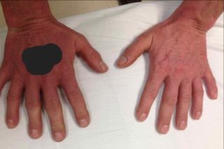 RARITA: Poznáte, co je na&nbsp;fotce rukou jinak? Touto vrozenou vadou trpí víc lidí, než byste čekali