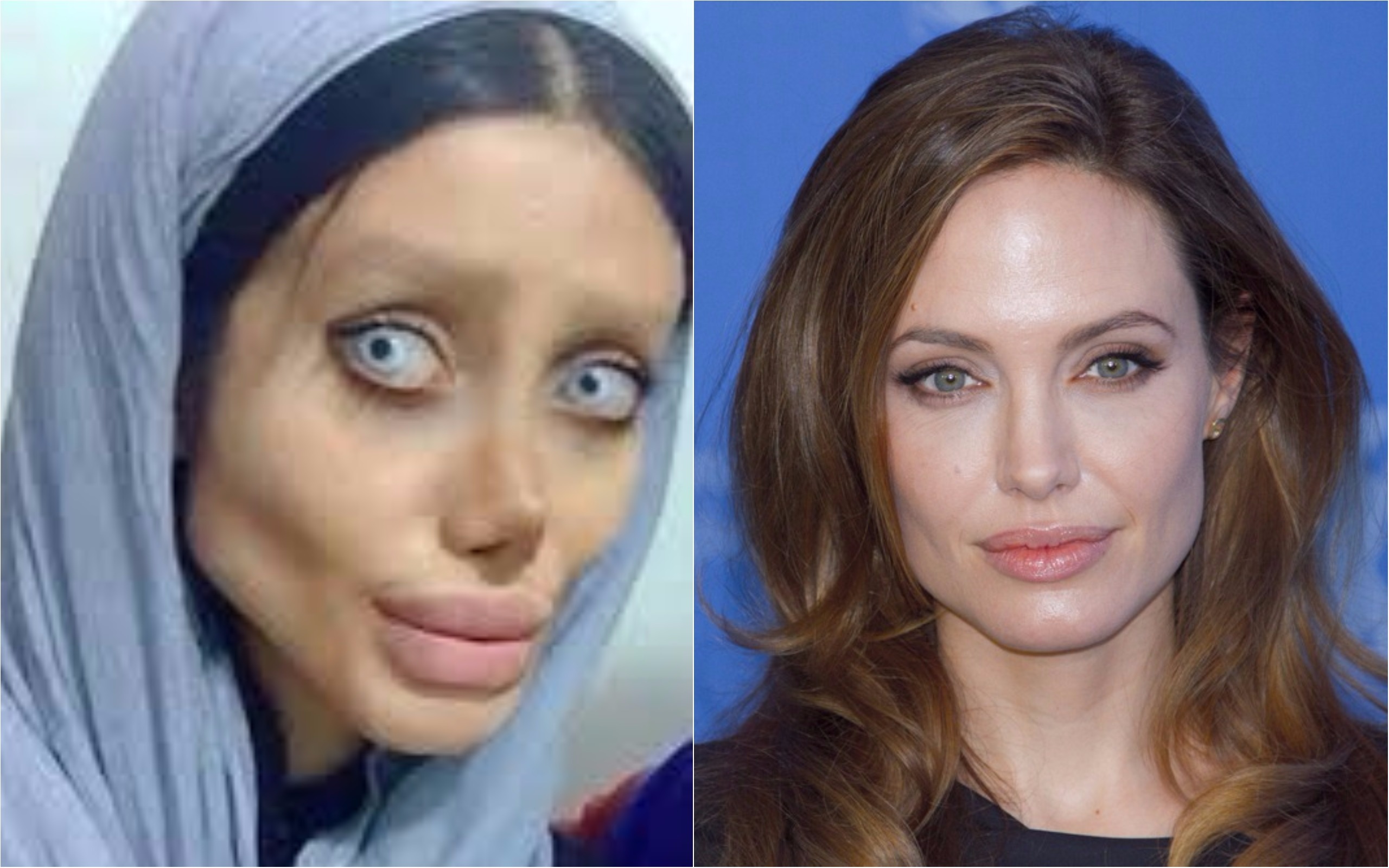 Šílená proměna! Dívka podstoupila 50 plastických operací, aby vypadala jako Angelina Jolie
