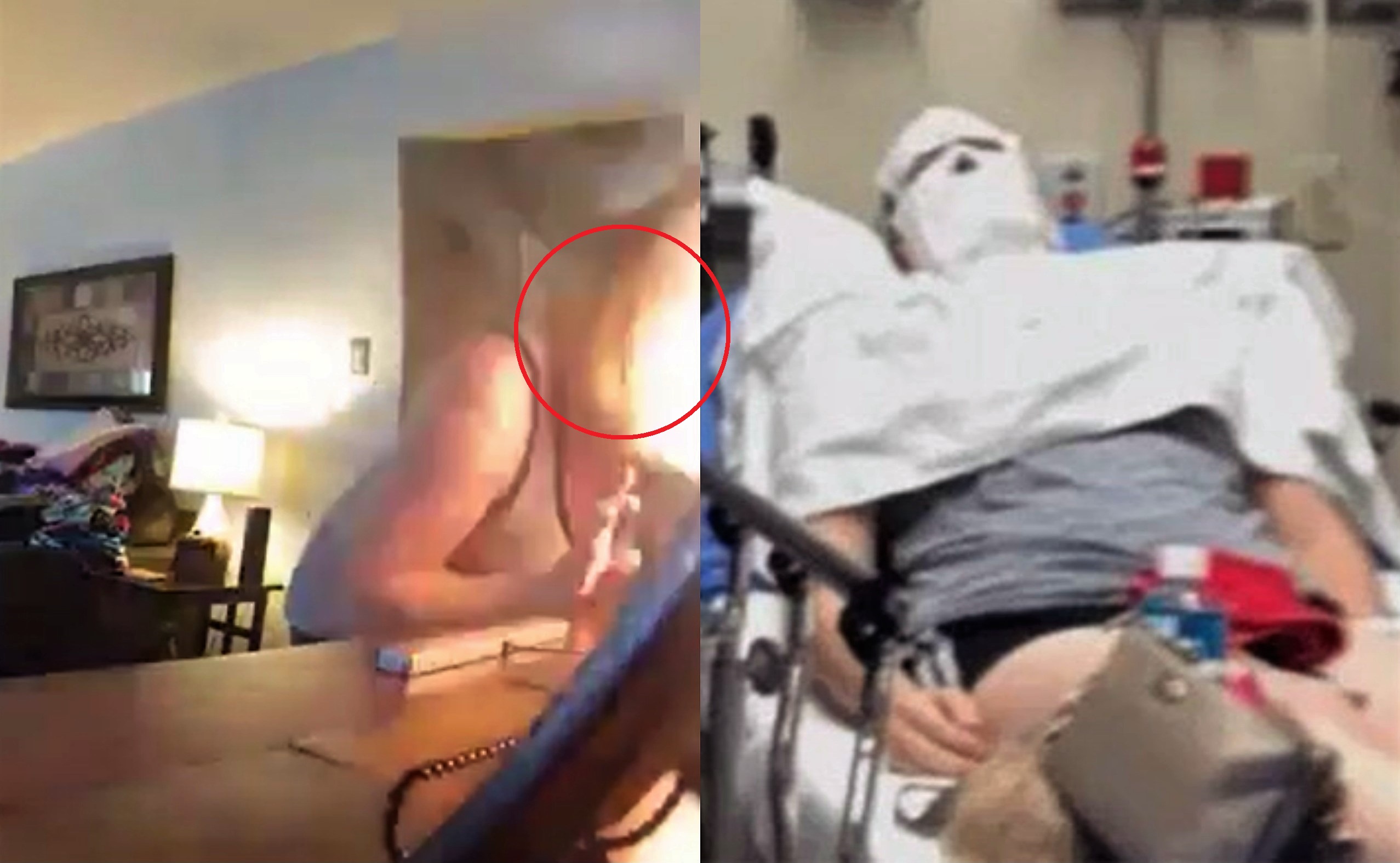 VIDEO: Chtěla sfouknout svíčku, ta jí explodovala přímo do tváře. Žena skončila v nemocnici