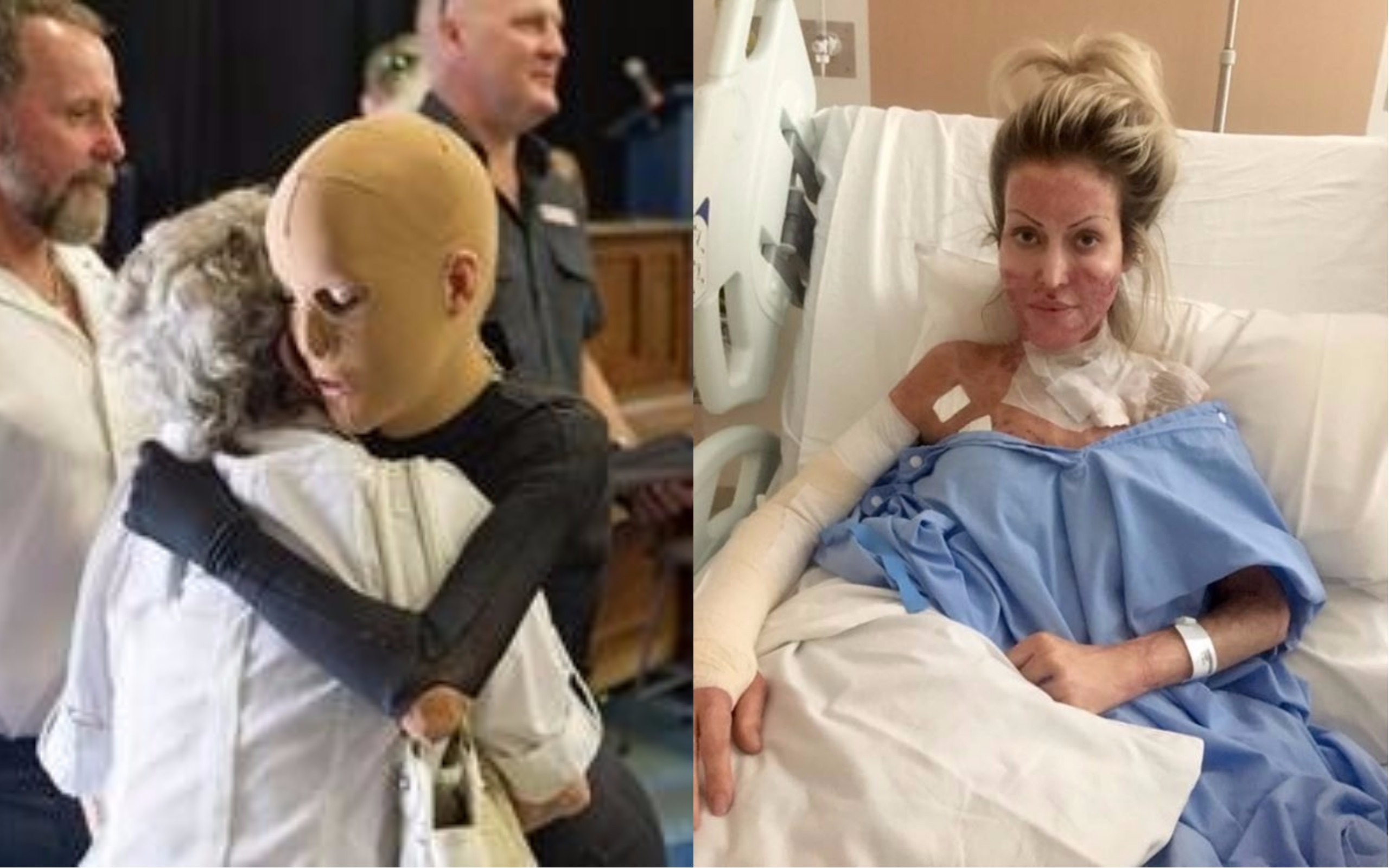 Žárlivá žena Daně způsobila děsivé zranění! Polila ji lihem a&nbsp;zapálila, když spala