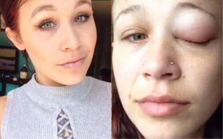 GALERIE: Modelka chtěla tetování do oka. Roní fialové slzy a&nbsp;je částečně slepá